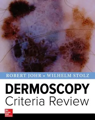 Révision des critères de dermoscopie - Dermoscopy Criteria Review