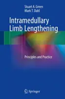 Allongement intramédullaire des membres : Principes et pratique - Intramedullary Limb Lengthening: Principles and Practice