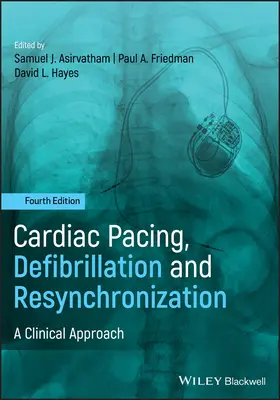 Stimulation cardiaque, défibrillation et resynchronisation : Une approche clinique - Cardiac Pacing, Defibrillation and Resynchronization: A Clinical Approach