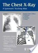 La radiographie du thorax : Atlas d'enseignement systématique - The Chest X-Ray: A Systematic Teaching Atlas