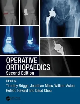 Orthopédie opératoire - Operative Orthopaedics