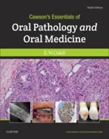 Cawson's Essentials of Oral Pathology and Oral Medicine (L'essentiel de la pathologie et de la médecine bucco-dentaires) - Cawson's Essentials of Oral Pathology and Oral Medicine