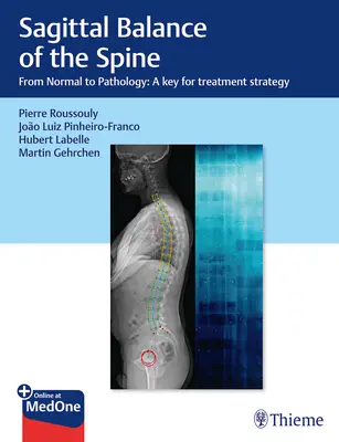 L'équilibre sagittal de la colonne vertébrale : De la normalité à la pathologie : Une clé pour la stratégie de traitement - Sagittal Balance of the Spine: From Normal to Pathology: A Key for Treatment Strategy