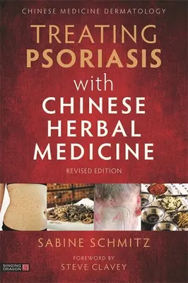 Traiter le psoriasis avec la phytothérapie chinoise (édition révisée) : Un manuel pratique - Treating Psoriasis with Chinese Herbal Medicine (Revised Edition): A Practical Handbook