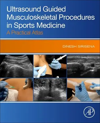 Procédures musculo-squelettiques guidées par ultrasons en médecine sportive - Atlas pratique - Ultrasound Guided Musculoskeletal Procedures in Sports Medicine - A Practical Atlas