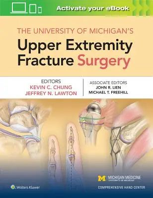 La chirurgie des fractures de l'extrémité supérieure de l'Université du Michigan - The University of Michigan's Upper Extremity Fracture Surgery