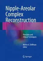 Reconstruction du complexe mamelon-aréole : Principes et techniques cliniques - Nipple-Areolar Complex Reconstruction: Principles and Clinical Techniques