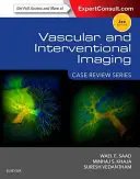 Imagerie vasculaire et interventionnelle : Série d'études de cas - Vascular and Interventional Imaging: Case Review Series