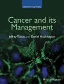 Le cancer et sa gestion - Cancer and Its Management