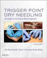 Trigger Point Dry Needling : Une approche fondée sur les preuves et la clinique - Trigger Point Dry Needling: An Evidence and Clinical-Based Approach
