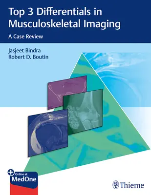 Les 3 principales différences en imagerie musculo-squelettique : Une revue de cas - Top 3 Differentials in Musculoskeletal Imaging: A Case Review