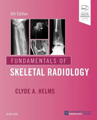 Principes fondamentaux de la radiologie du squelette - Fundamentals of Skeletal Radiology