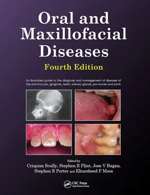 Maladies bucco-dentaires et maxillo-faciales, quatrième édition - Oral and Maxillofacial Diseases, Fourth Edition