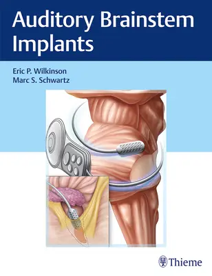 Implants auditifs du tronc cérébral - Auditory Brainstem Implants