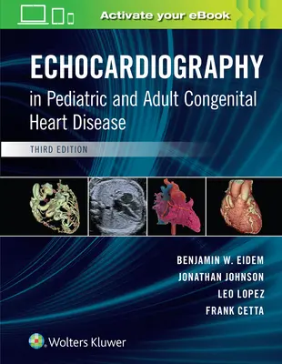 L'échocardiographie dans les cardiopathies congénitales de l'enfant et de l'adulte - Echocardiography in Pediatric and Adult Congenital Heart Disease