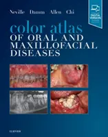 Atlas en couleur des maladies bucco-dentaires et maxillo-faciales - Color Atlas of Oral and Maxillofacial Diseases