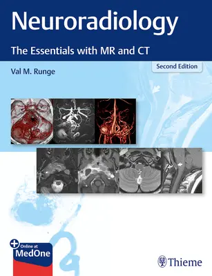 Neuroradiologie : L'essentiel avec la RM et la TDM - Neuroradiology: The Essentials with MR and CT