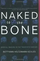 Nu jusqu'à l'os : l'imagerie médicale au vingtième siècle - Naked to the Bone: Medical Imaging in the Twentieth Century
