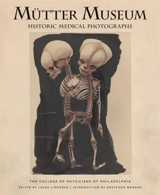 Musée Mtter : Photographies médicales historiques - Mtter Museum Historic Medical Photographs