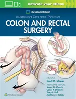 Cleveland Clinic Illustrated Tips and Tricks in Colon and Rectal Surgery (Conseils et astuces illustrés de la clinique de Cleveland pour la chirurgie du côlon et du rectum) - Cleveland Clinic Illustrated Tips and Tricks in Colon and Rectal Surgery