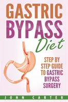 Régime bypass gastrique : Guide étape par étape pour la chirurgie de dérivation gastrique - Gastric Bypass Diet: Step By Step Guide to Gastric Bypass Surgery