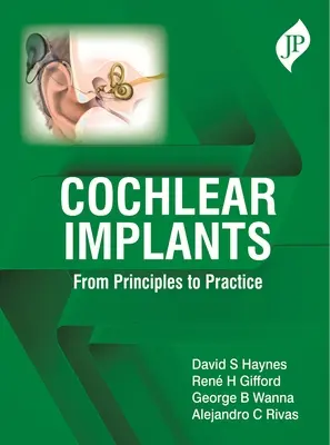 Implants cochléaires - Des principes à la pratique - Cochlear Implants - From Principles to Practice