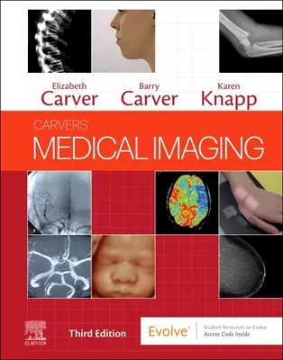 L'imagerie médicale de Carvers - Carvers' Medical Imaging