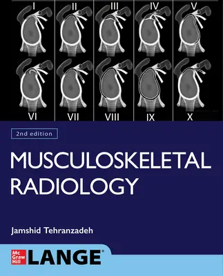 L'imagerie musculo-squelettique de base, deuxième édition - Basic Musculoskeletal Imaging, Second Edition