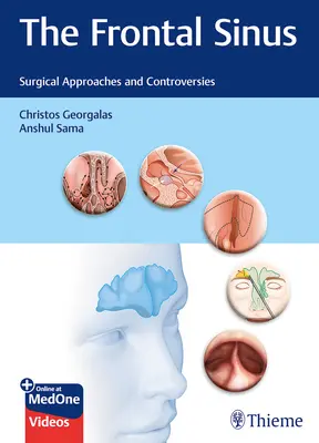 Le sinus frontal : Approches chirurgicales et controverses - The Frontal Sinus: Surgical Approaches and Controversies