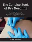 Concise Book of Dry Needling - A Practitioner's Guide to Myofascial Trigger Point Applications (en anglais) - Concise Book of Dry Needling - A Practitioner's Guide to Myofascial Trigger Point Applications