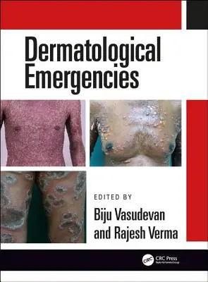 Urgences dermatologiques - Dermatological Emergencies