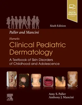 Paller et Mancini - Hurwitz Clinical Pediatric Dermatology : Un manuel des troubles cutanés de l'enfance et de l'adolescence - Paller and Mancini - Hurwitz Clinical Pediatric Dermatology: A Textbook of Skin Disorders of Childhood & Adolescence