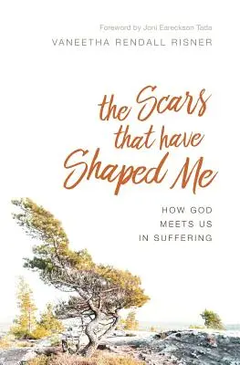 Les cicatrices qui m'ont façonné : Comment Dieu nous rencontre dans la souffrance - The Scars That Have Shaped Me: How God Meets Us in Suffering