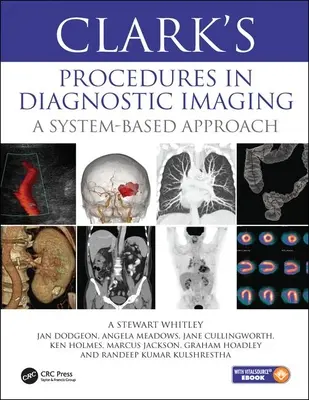 Les procédures de Clark en imagerie diagnostique - Une approche basée sur le système - Clark's Procedures in Diagnostic Imaging - A System-Based Approach