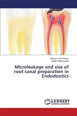 Microfuites et taille de la préparation du canal radiculaire en endodontie - Microleakage and size of root canal preparation in Endodontics