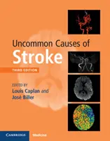 Causes peu communes d'accident vasculaire cérébral - Uncommon Causes of Stroke