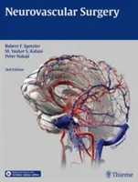 Chirurgie neurovasculaire - Neurovascular Surgery