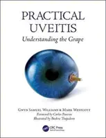 L'uvéite pratique : Comprendre le raisin - Practical Uveitis: Understanding the Grape