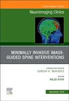 Spine Intervention, An Issue of Neuroimaging Clinics of North America (en anglais) - Spine Intervention, An Issue of Neuroimaging Clinics of North America