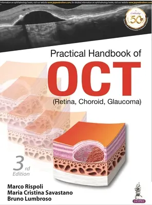 Manuel pratique d'OCT - (rétine, choroïde, glaucome) - Practical Handbook of OCT - (Retina, Choroid, Glaucoma)