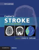 Caplan's Stroke : Une approche clinique - Caplan's Stroke: A Clinical Approach