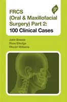 Frcs (Chirurgie buccale et maxillo-faciale) Partie 2 : 100 cas cliniques - Frcs (Oral & Maxillofacial Surgery) Part 2: 100 Clinical Cases