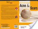 ACNE et SCARS - ACNE and SCARS