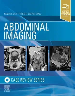 Imagerie abdominale : Case Review Series - Abdominal Imaging: Case Review Series