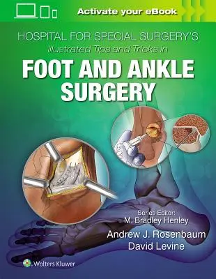 Conseils et astuces illustrés en chirurgie du pied et de la cheville de l'Hospital for Special Surgery - Hospital for Special Surgery's Illustrated Tips and Tricks in Foot and Ankle Surgery