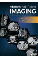 Imagerie abdominale et pelvienne - 200 cas (maladies courantes) : US, CT et IRM - Abdominal-Pelvic Imaging - 200 Cases (Common Diseases): US, CT and MRI