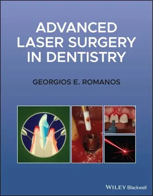 Chirurgie laser avancée en dentisterie - Advanced Laser Surgery in Dentistry