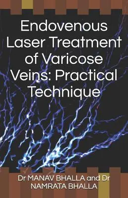 Traitement des varices par laser endoveineux : Technique pratique - Endovenous Laser Treatment of Varicose Veins: Practical Technique