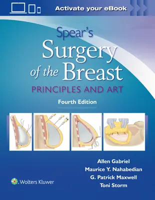 Chirurgie mammaire de Spear : Principes et art - Spear's Surgery of the Breast: Principles and Art
