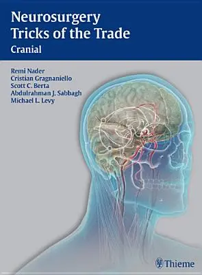 Trucs et astuces de la neurochirurgie - crânienne : Crâne - Neurosurgery Tricks of the Trade - Cranial: Cranial